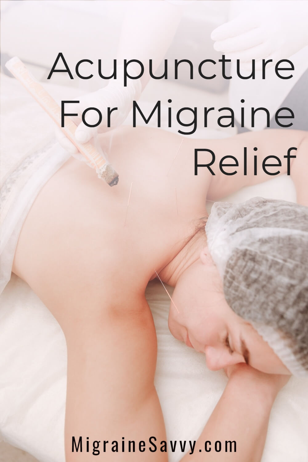 Here are some proven and effective migraine relief acupuncture points for you to use at home @migrainesavvy #migrainerelief #stopmigraines #migraines