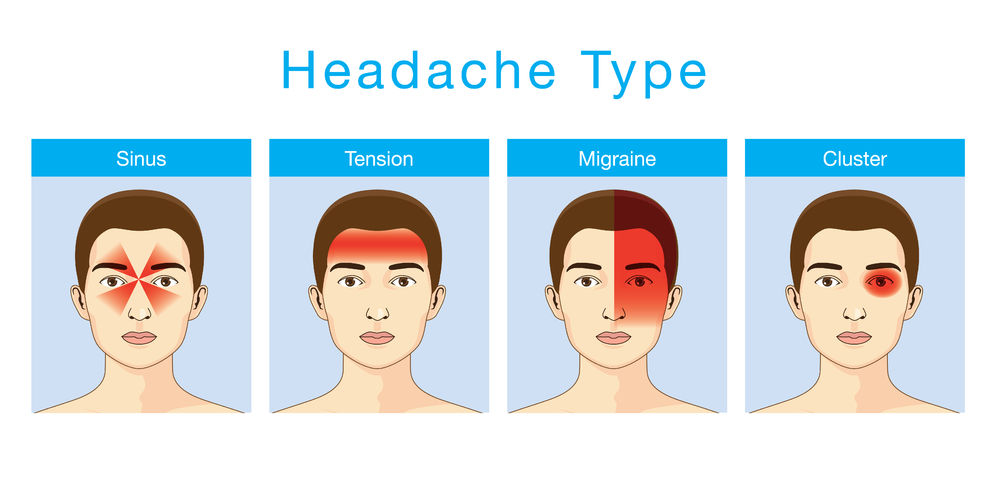 Cluster Migraines 1000 Out Of Ten On The Pain Scale