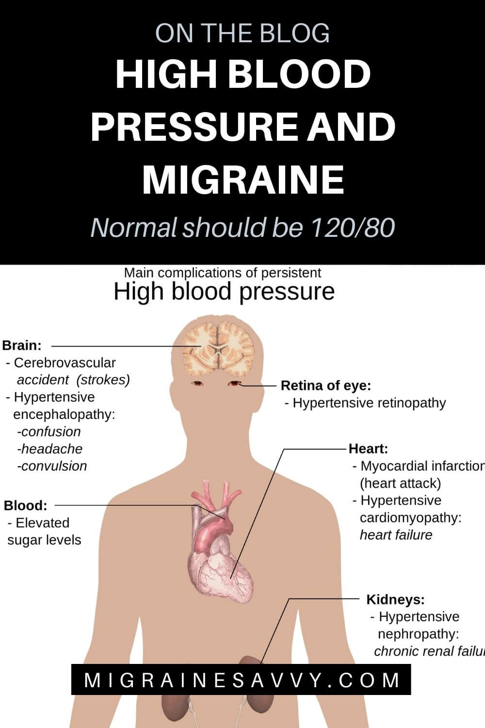 high-blood-pressure-and-migraine-can-it-cause-an-attack