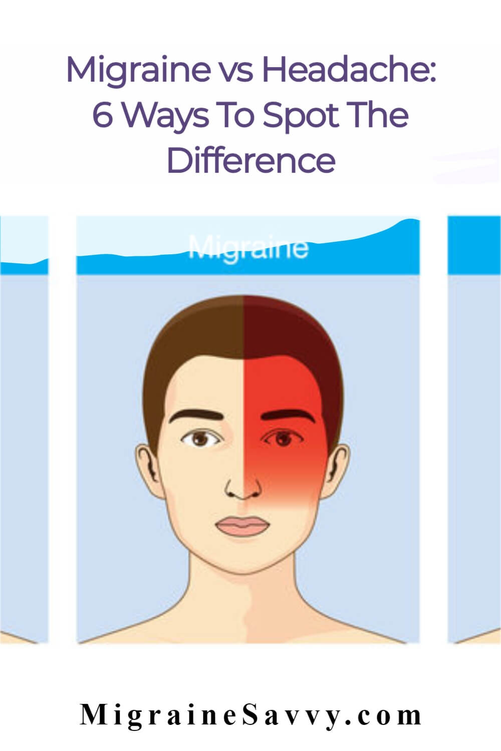 Migraine vs Headache: 6 Ways To Spot The Difference @migrainesavvy #migraines #headaches